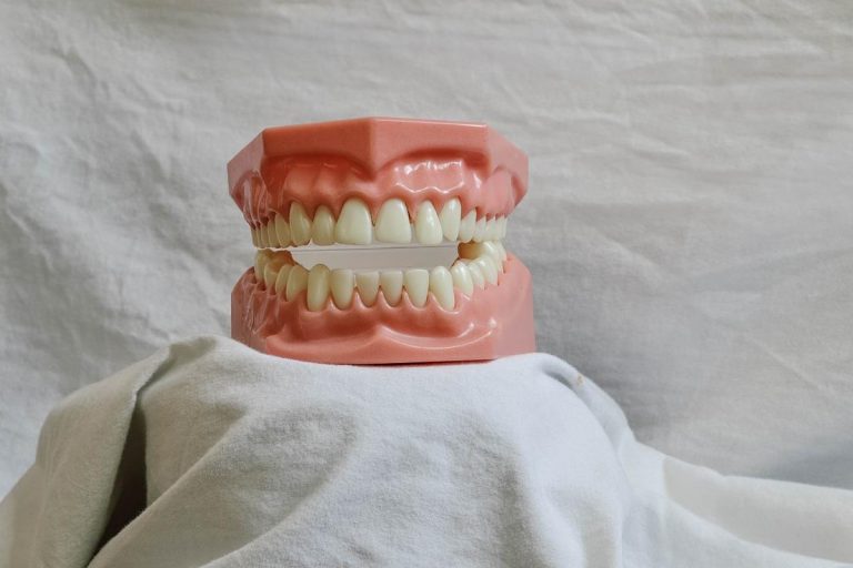 Czy już myślicie o aparacie ortodontycznym?